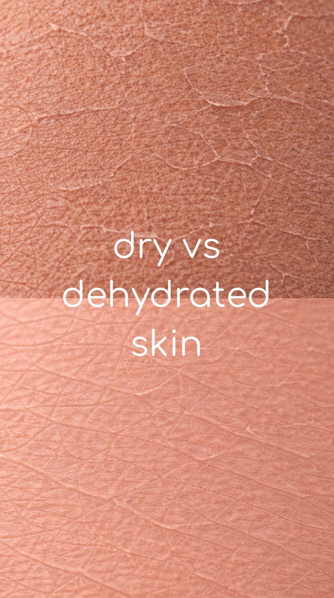 Dry vs Dehydrated Skin: What Your Skin Is Actually Asking For