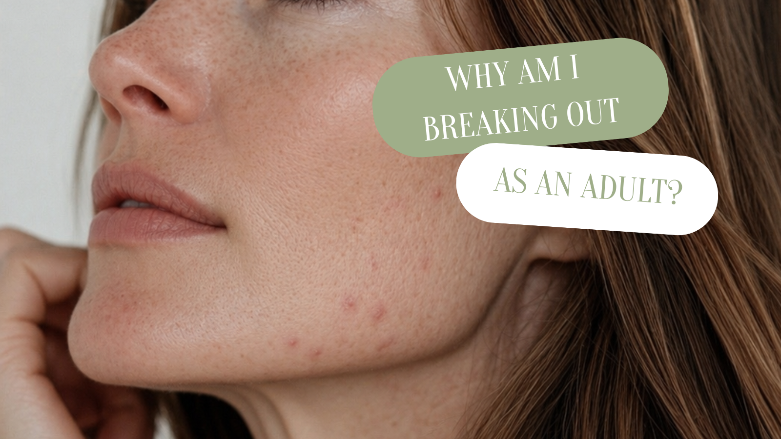 Why Am I Breaking Out as an Adult? (Hormones, Stress & Your Skin Barrier Explained)